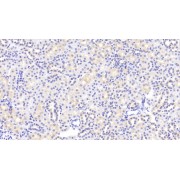 IHC-P analysis of Rat Kidney Tissue, with DAB staining, using Rabbit Anti-Rat APOC2 Antibody (20 µg/ml) and HRP-conjugated Goat Anti-Rabbit antibody (<a href="https://www.abbexa.com/index.php?route=product/search&amp;search=abx400043" target="_blank">abx400043</a>, 2 µg/ml).