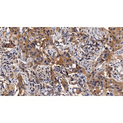 Beta-2-Microglobulin (B2M) Antibody