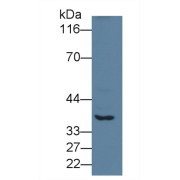 Western blot analysis of Human Lung lysate, using Rabbit Anti-Human CTSE Antibody (0.2 µg/ml) and HRP-conjugated Goat Anti-Rabbit antibody (<a href="https://www.abbexa.com/index.php?route=product/search&amp;search=abx400043" target="_blank">abx400043</a>, 0.2 µg/ml).