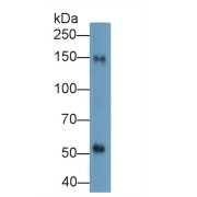 Western blot analysis of Human Placenta lysate, using Rabbit Anti-Human CD163 Antibody (0.5 µg/ml) and HRP-conjugated Goat Anti-Rabbit antibody (<a href="https://www.abbexa.com/index.php?route=product/search&amp;search=abx400043" target="_blank">abx400043</a>, 0.2 µg/ml).