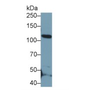 Western blot analysis of Rat Testis lysate, using Rabbit Anti-Human EMILIN2 Antibody (0.2 µg/ml) and HRP-conjugated Goat Anti-Rabbit antibody (<a href="https://www.abbexa.com/index.php?route=product/search&amp;search=abx400043" target="_blank">abx400043</a>, 0.2 µg/ml).