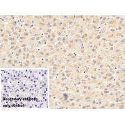 IHC-P analysis of Pig Liver Tissue, with DAB staining, using Eosinophil Peroxidase (EPX) Antibody (10 µg/ml) and HRP-conjugated Goat Anti-Rabbit antibody (<a href="https://www.abbexa.com/index.php?route=product/search&amp;search=abx400043" target="_blank">abx400043</a>, 2 µg/ml). PBS was used instead of the primary antibody for the control.
