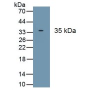 Western blot analysis of recombinant Human HPS6.