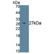 Western blot analysis of recombinant Rat KLK1B3.