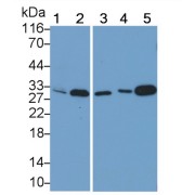 Western blot analysis of (1) Mouse Skeletal muscle lysate, (2) Mouse Heart lysate, (3) Rat Heart lysate, (4) Pig Skeletal muscle lysate, and (5) Pig Heart lysate, using Rabbit Anti-Mouse MYOG Antibody (0.2 µg/ml) and HRP-conjugated Goat Anti-Rabbit antibody (<a href="https://www.abbexa.com/index.php?route=product/search&amp;search=abx400043" target="_blank">abx400043</a>, 0.2 µg/ml).