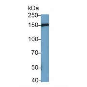 abx177669