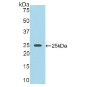 abx177803