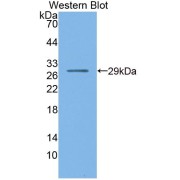 Western blot analysis of recombinant Mouse NR0B1 Protein.