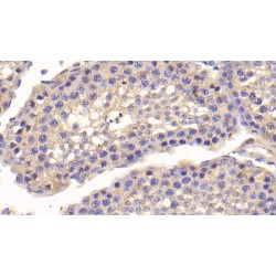 Osteocalcin (BGLAP) Antibody