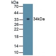 Western blot analysis of recombinant Rat ABCB1/Pgp Protein.