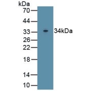 abx177960