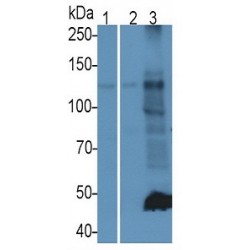 ATP-Dependent Translocase ABCB1 (ABCB1) Antibody