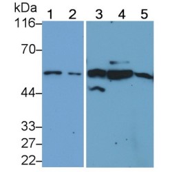 E3 Ubiquitin-Protein Ligase TRIM21 (TRIM21) Antibody