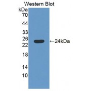 Western blot analysis of recombinant Mouse SAT1.