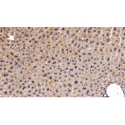 IHC-P analysis of Mouse Liver Tissue, with DAB staining, using Rabbit Anti-Mouse TRPM4 Antibody (20 µg/ml) and HRP-conjugated Goat Anti-Rabbit antibody (<a href="https://www.abbexa.com/index.php?route=product/search&amp;search=abx400043" target="_blank">abx400043</a>, 2 µg/ml).