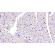 IHC-P analysis of Rabbit Cardiac Muscle Tissue, with DAB staining, using Mouse Anti-Rabbit IL1b Antibody (40 µg/ml) and HRP-conjugated Goat Anti-Mouse antibody (<a href="https://www.abbexa.com/index.php?route=product/search&amp;search=abx400001" target="_blank">abx400001</a>, 0.2 µg/ml).