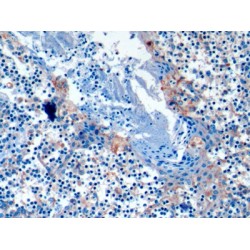 Programmed Cell Death 1 Ligand 1 (CD274) Antibody