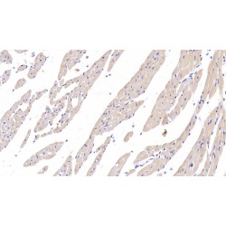 Programmed Cell Death 1 Ligand 1 (CD274) Antibody