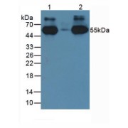 Western blot analysis of the recombinant protein.