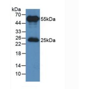 Western blot analysis of the recombinant protein, using HRP-conjugated Rabbit Anti-Sheep IgG Antibody (1/2000 dilution).