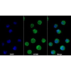 Myeloperoxidase (MPO) Antibody