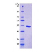 SDS-PAGE analysis of Human GFM1 Protein.