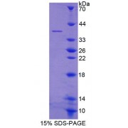 SDS-PAGE analysis of Human GYPE Protein.