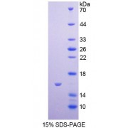 SDS-PAGE analysis of Human GRPR Protein.