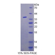 SDS-PAGE analysis of Human HIPK1 Protein.