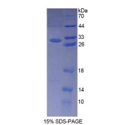 SDS-PAGE analysis of Human NPHP2 Protein.