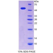 SDS-PAGE analysis of Mouse ITPA Protein.