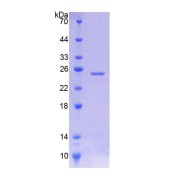 SDS-PAGE analysis of Human JPH1 Protein.