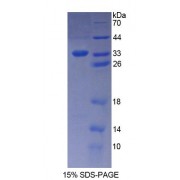 SDS-PAGE analysis of Human KATNA1 Protein.