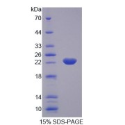 SDS-PAGE analysis of Rat KTN1 Protein.