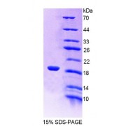 SDS-PAGE analysis of Rat LDOC1 Protein.