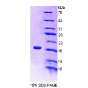 SDS-PAGE analysis of Rat LDOC1 Protein.