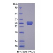 SDS-PAGE analysis of Rat EIF2D Protein.
