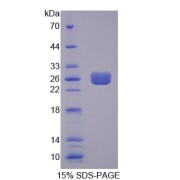 SDS-PAGE analysis of Rat EIF2D Protein.