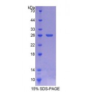 SDS-PAGE analysis of Human LIM2 Protein.