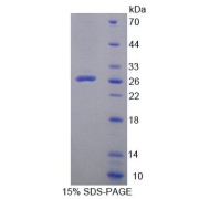 SDS-PAGE analysis of Mouse LPXN Protein.