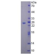 SDS-PAGE analysis of Human LRDD Protein.