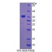 SDS-PAGE analysis of Rat LSP1 Protein.
