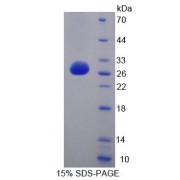 SDS-PAGE analysis of Human LYPLA1 Protein.