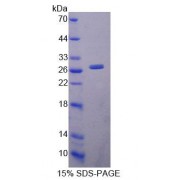 SDS-PAGE analysis of Mouse LYPLA1 Protein.