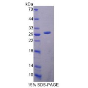 SDS-PAGE analysis of Mouse LYPLA1 Protein.