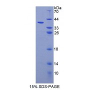 SDS-PAGE analysis of Human UBAP1 Protein.