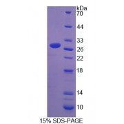 SDS-PAGE analysis of Mouse UPb1 Protein.