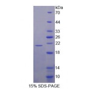 SDS-PAGE analysis of Human UXT Protein.