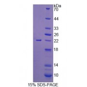 SDS-PAGE analysis of Mouse UMPS Protein.