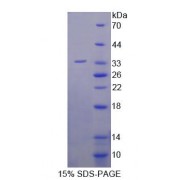 SDS-PAGE analysis of Human XYLT2 Protein.